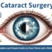 Cataract Surgery